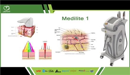 فروش دستگاه لیزر موهای زائد ۲۰۱۹